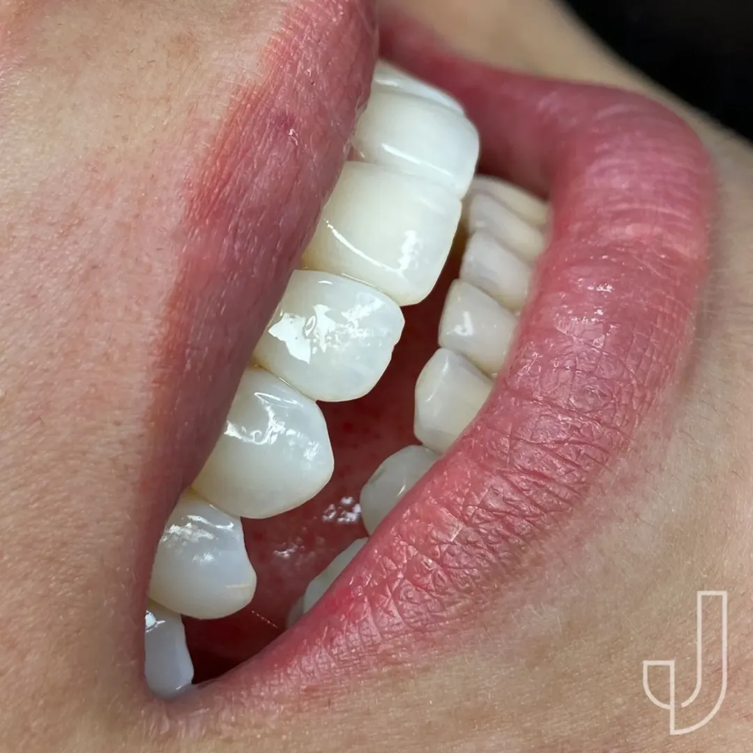 snapinsta.com.br-69c1b4a28de8e